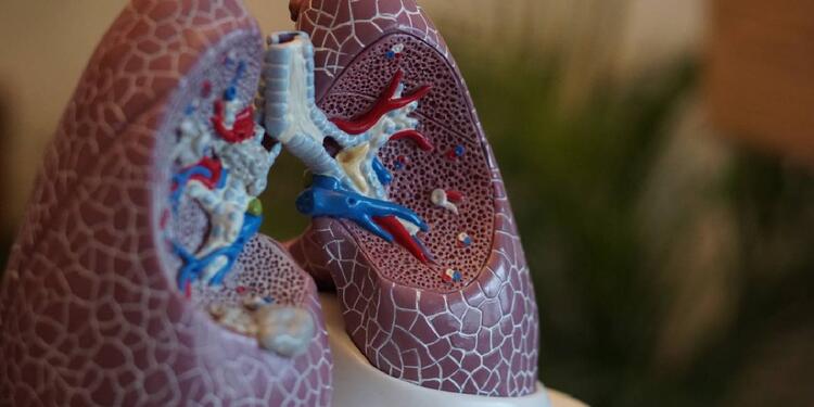 Hipertensión Arterial Pulmonar Hipertensión Arterial Pulmonar