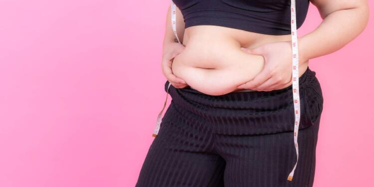 Mujer con obesidad mórbida Mujer con obesidad mórbida