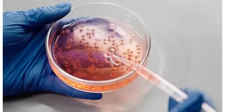 Las bacterias son la segunda causa de muerte a nivel mundial