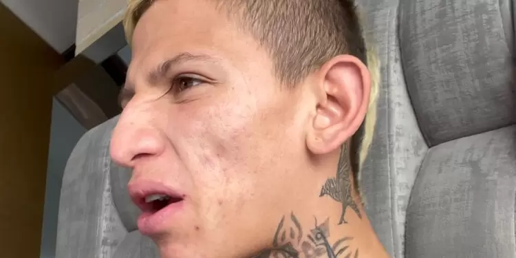 La Liendra se quitó los brackets. La Liendra se quitó los brackets