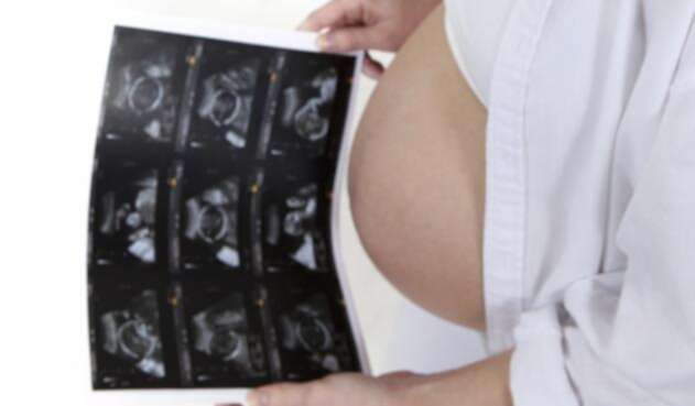 65% de colombianos aprueba la legalización del aborto, según la primera Encuesta de percepción sobre la interrupción de embarazo