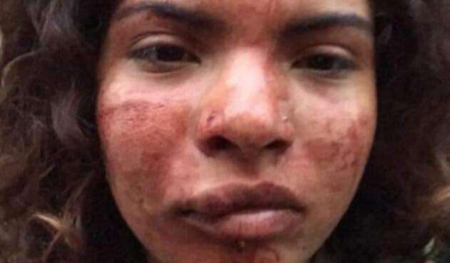 Nicol Valentina Jiménez, víctima de racismo en Portugal