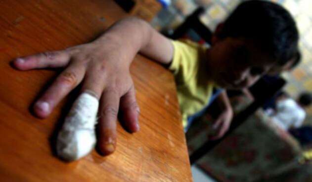 El uso de pólvora en Colombia sigue dejando como víctimas principalmente a los niños.