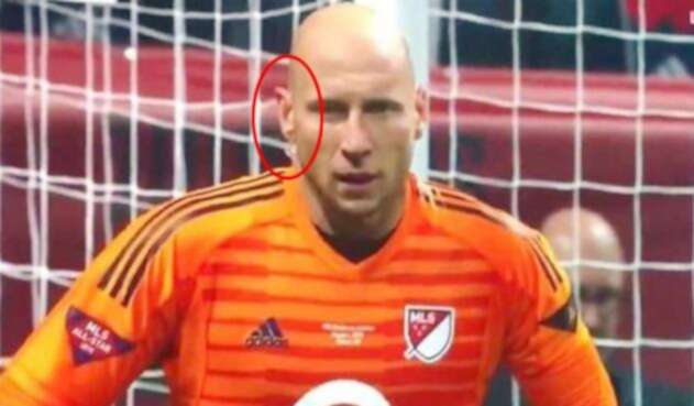 El arquero Brad Guzan en el Partido de las Estrellas de la MLS