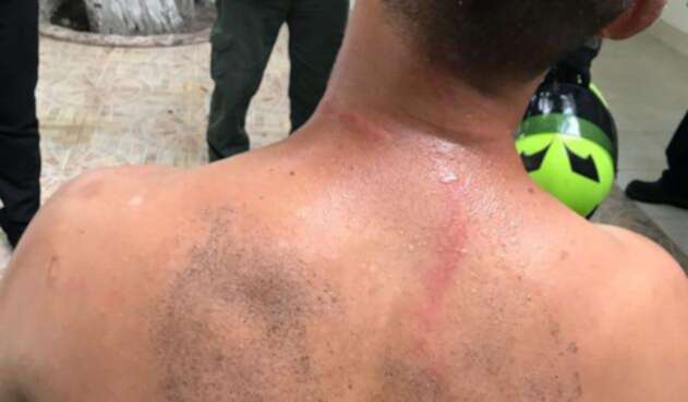 Sufrió golpes y patadas en diferentes partes del cuerpo