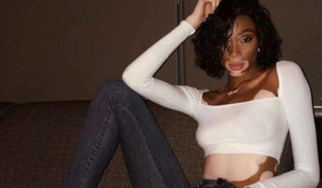 Winnie Harlow