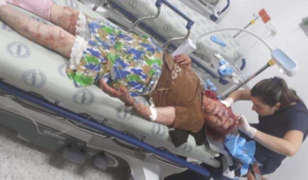La adulta mayor sufrió graves heridas en el rostro y la cabeza.
