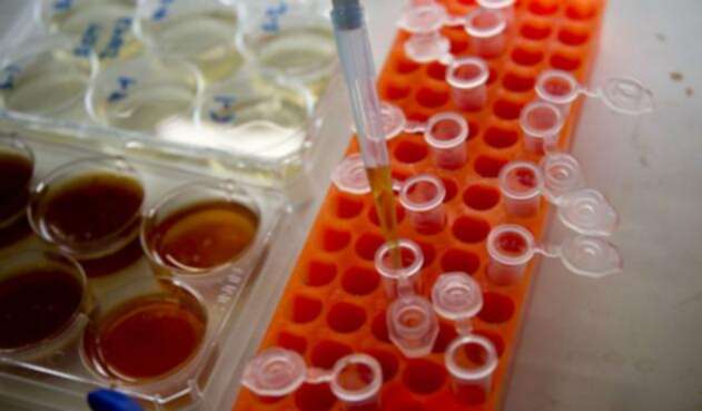 En Colombia las bacterias resistentes a los antibióticos ha incrementado. En Colombia las bacterias resistentes a los antibióticos ha incrementado.