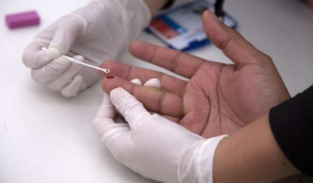 Prueba para detectar el VIH. Prueba VIH