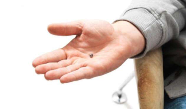 Chip implantado en la mano