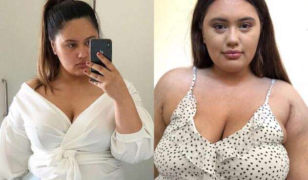 La joven superó los problemas de adicción a la comida.