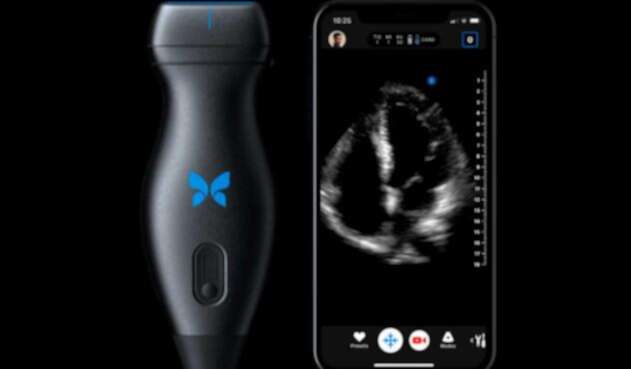 Escáner Butterfly IQ que se conecta a un iPhone