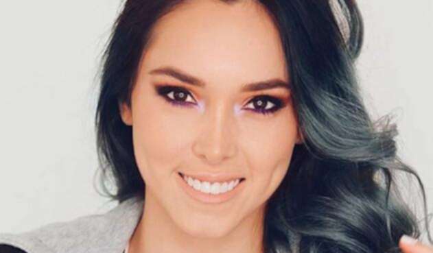 La youtuber plasmó en redes sociales el accidente que sufrió su dentadura