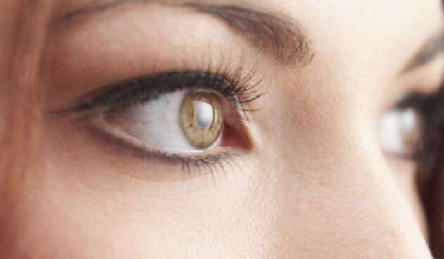 Ojos