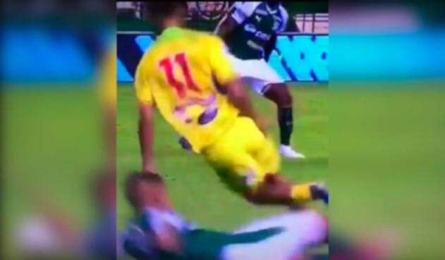 Patada de Julián Zea a Andrés Amaya (Huila vs Cali)