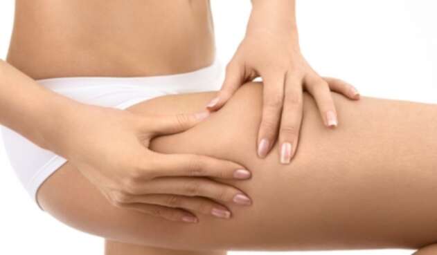 Celulitis Celulitis