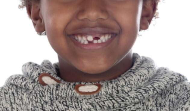 Dientes de leche
