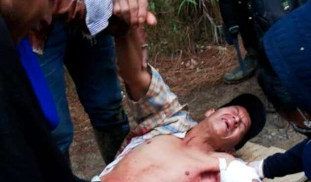 El indígena Breiner Yunda Camayo tras ser impactado en medio de la minga