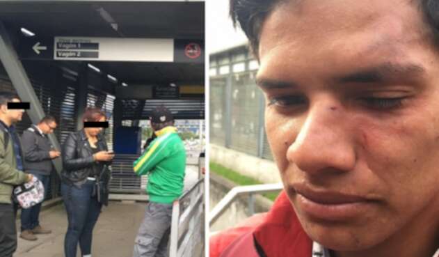 Agredido en Transmilenio