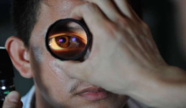 Lentes de contacto