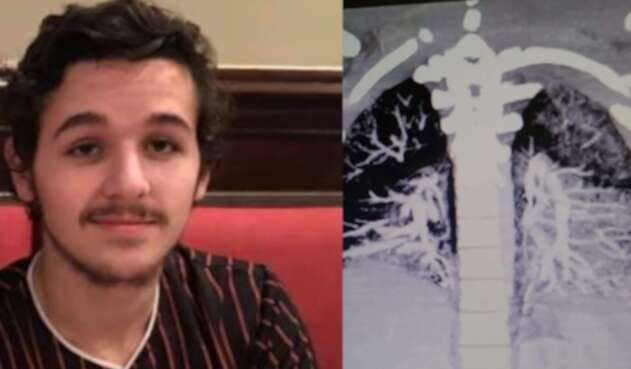 Anthony Mayo