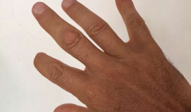 Mano de Enrique Peñalosa Mano de Enrique Peñalosa