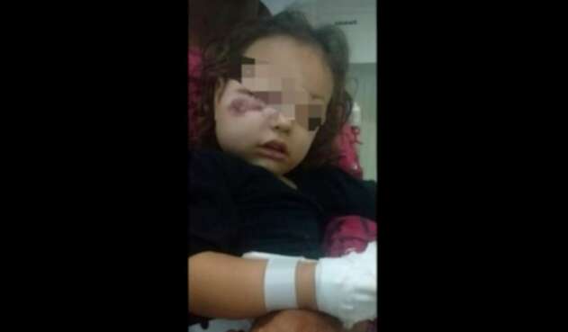 Fotos de la niña agredida han dejado constancia de la violencia con la que fue golpeada
