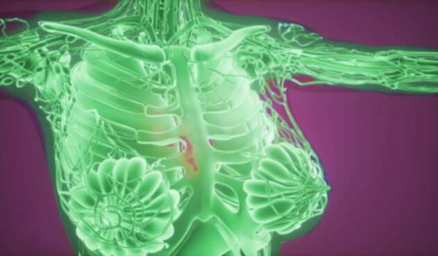 Tecnología detectaría cáncer de seno
