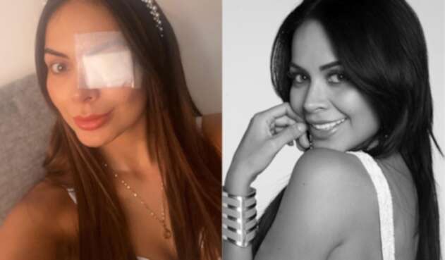 Laura González Díaz y el problema con su ojo Laura González Díaz y el problema con su ojo