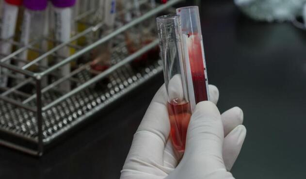 Examen de sangre Examen de sangre