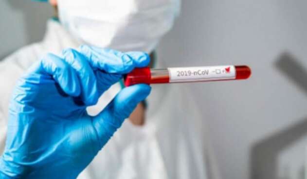 Prueba de coronavirus