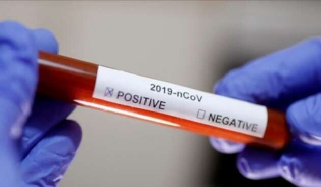 Pruebas de coronavirus en Colombia