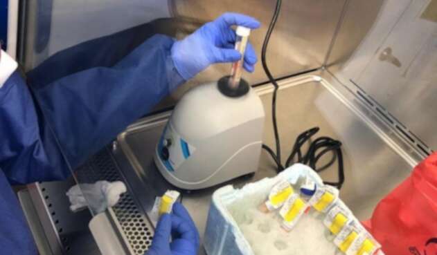 Pruebas PCR