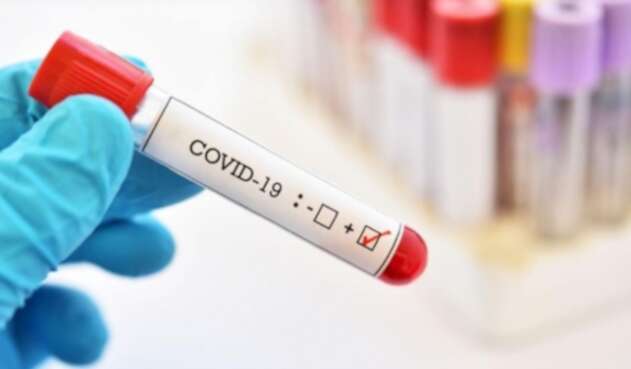 Prueba de coronavirus Prueba de coronavirus