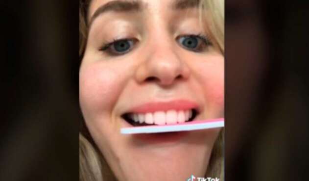 Limar dientes, peligrosa tendencia en Tiktok