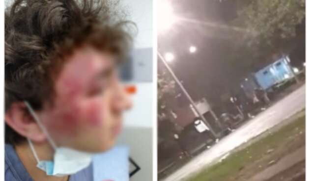 Golpiza a menor en Suba