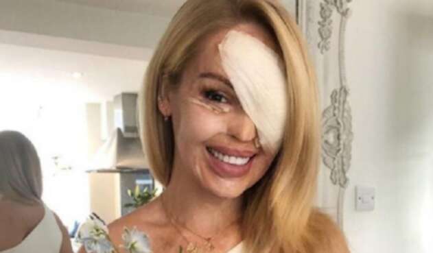 Katie Piper Katie Piper