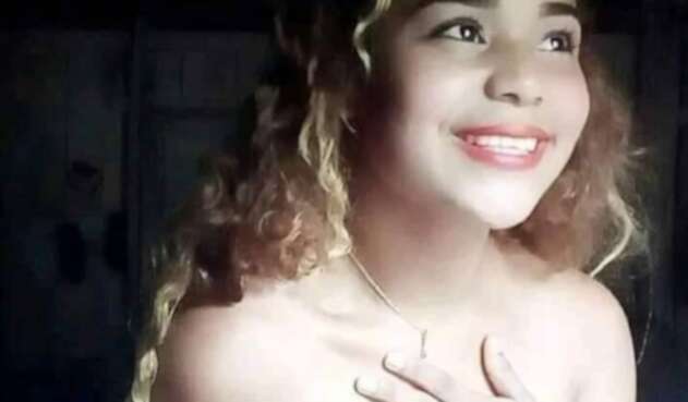 El cuerpo de la menor quedó con quemaduras de segundo y tercer grado