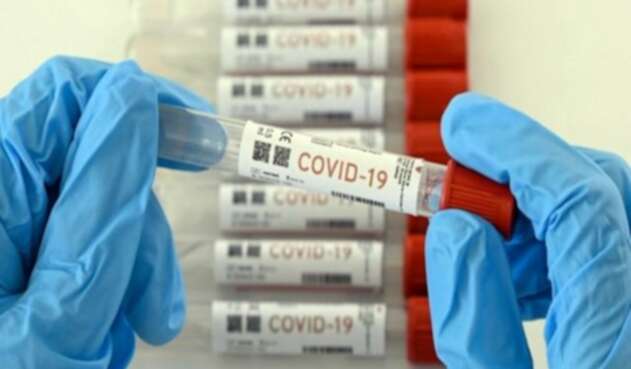 Pruebas Covid-19 imagen de referencia