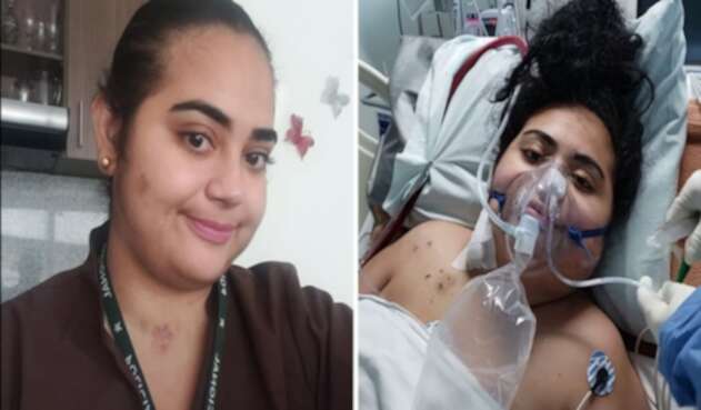 Médica colombiana olvidó hablar y escribir tras enfrentar el coronavirus