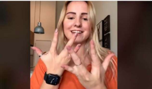 Alyssa, la joven que tiene solo cuatro dedos en sus manos