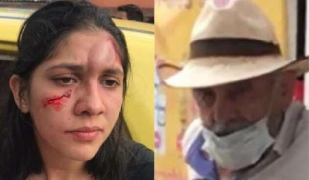 Mujer agredida
