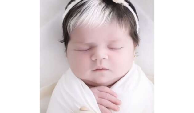 Niña con canas por extraña condición genética Niña con canas por extraña condición genética