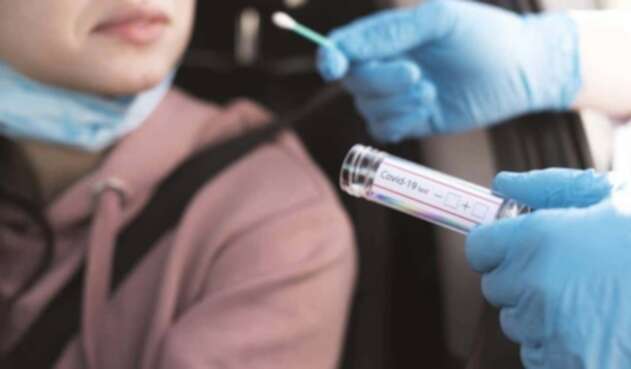 Prueba PCR Prueba PCR