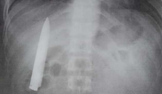 Hoja de cuchillo en un cuerpo