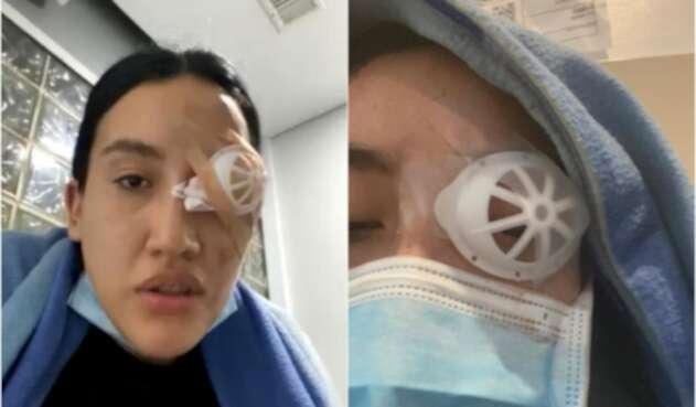 Universitaria perdió el ojo tras las protestas en Bogotá Universitaria perdió el ojo tras las protestas en Bogotá
