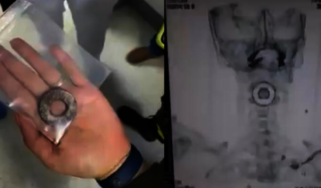 Policía herido Bucaramanga