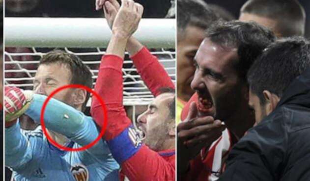 DiegoGodinAtleticoAFP.jpg