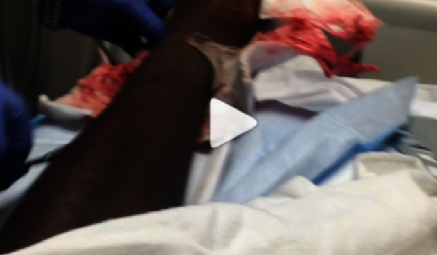 JacksonMartinez.png