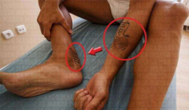 LesionCazorlaMarca1.jpg